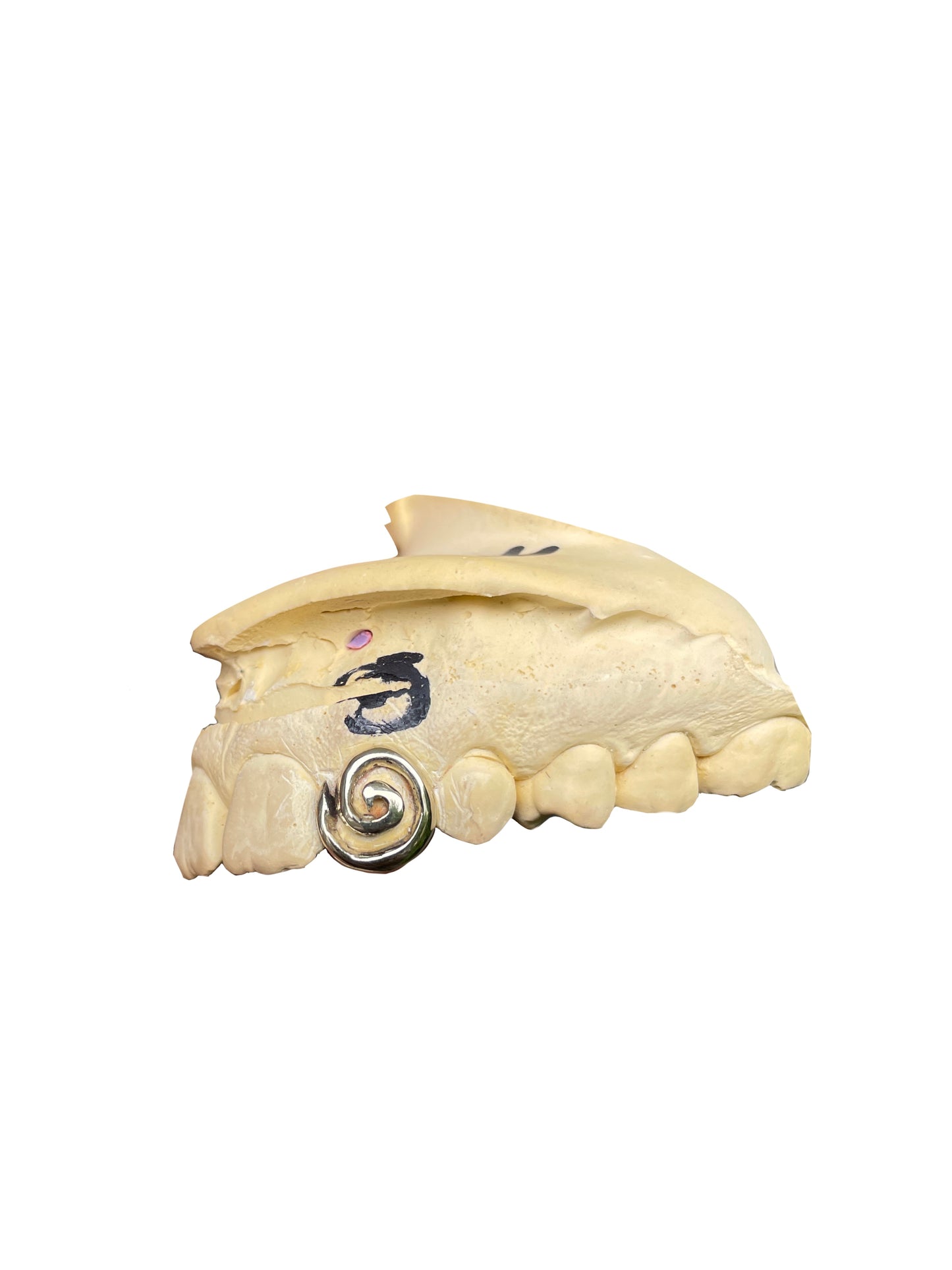 Spiral (1 - 3 Teeth)