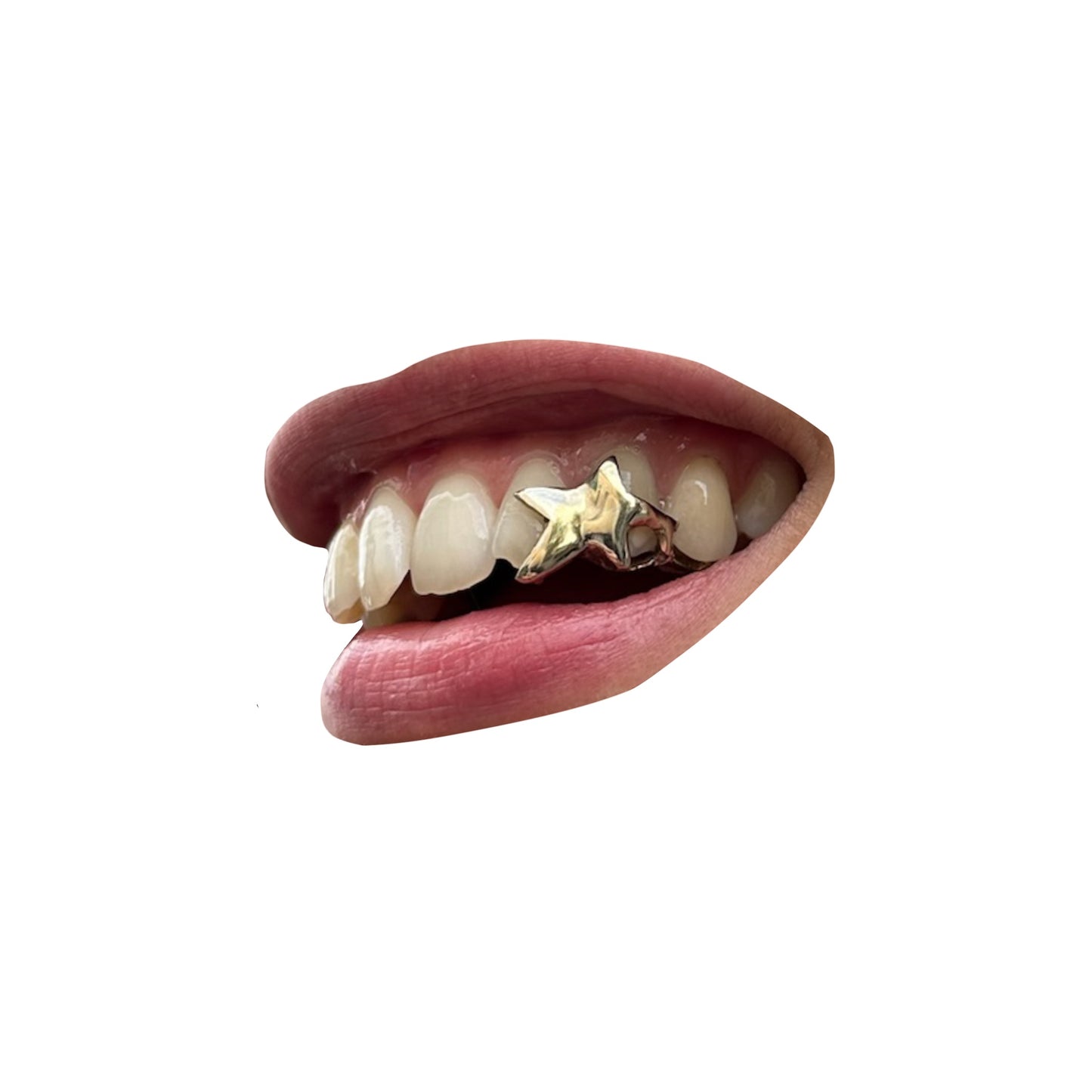Solid Star (1 - 3 Teeth)