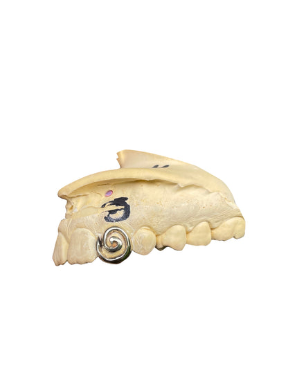 Spiral (1 - 3 Teeth)
