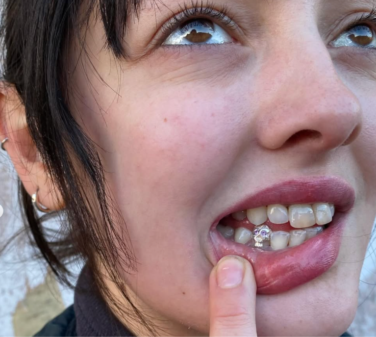 Skull Grillz 💀