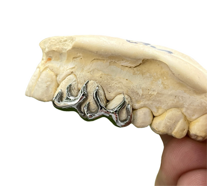 Flames (1 - 3 Teeth)