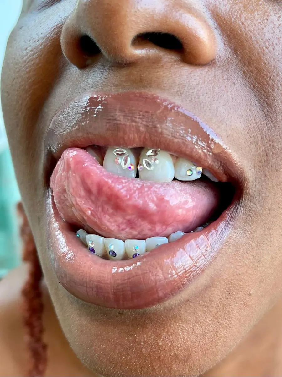 Tuff Tooth Gemz tooth gem smile 4