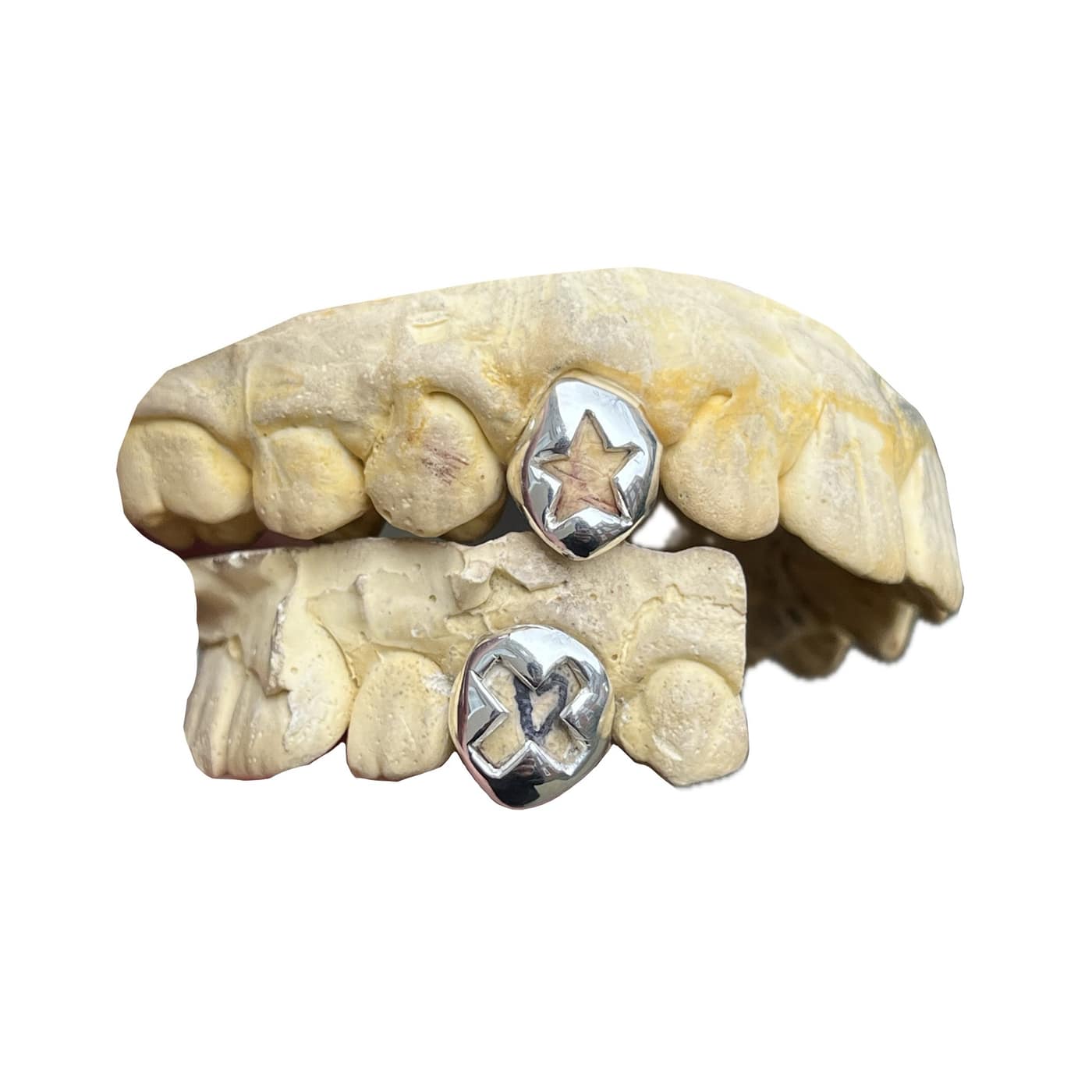 Tuff Tooth custom grillz photo 8